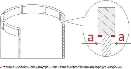 Внешнее и внутреннее нависание сегмента над корпусом коронки